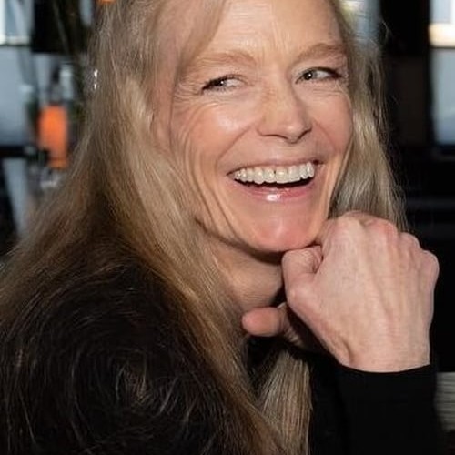 Suzy Amis